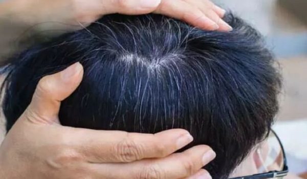 مطالعه جدید ارتباط پنهان میان سفیدی مو و سرطان را نشان می‌دهد