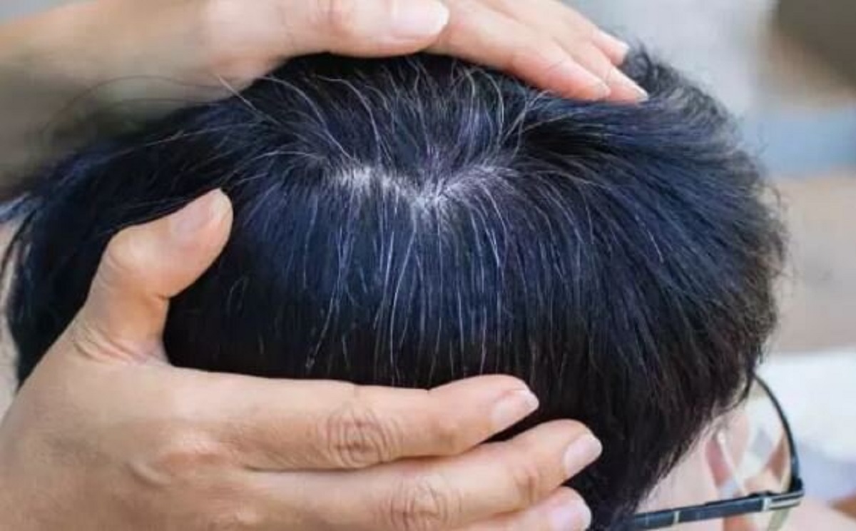 مطالعه جدید ارتباط پنهان میان سفیدی مو و سرطان را نشان می‌دهد