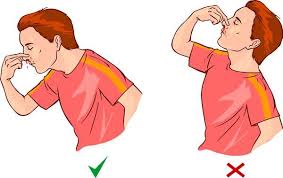 چطور خون‌دماغ را در چند دقیقه متوقف کنیم؟